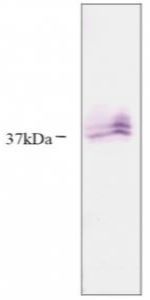 KLK5 | Kallikrein 5 in the group Antibodies Human Cell Biology / Other proteins at Agrisera AB (Antibodies for research) (AS06 102)